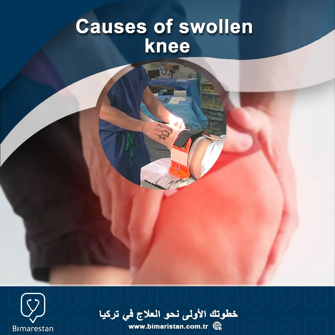 Causes of swollen knee