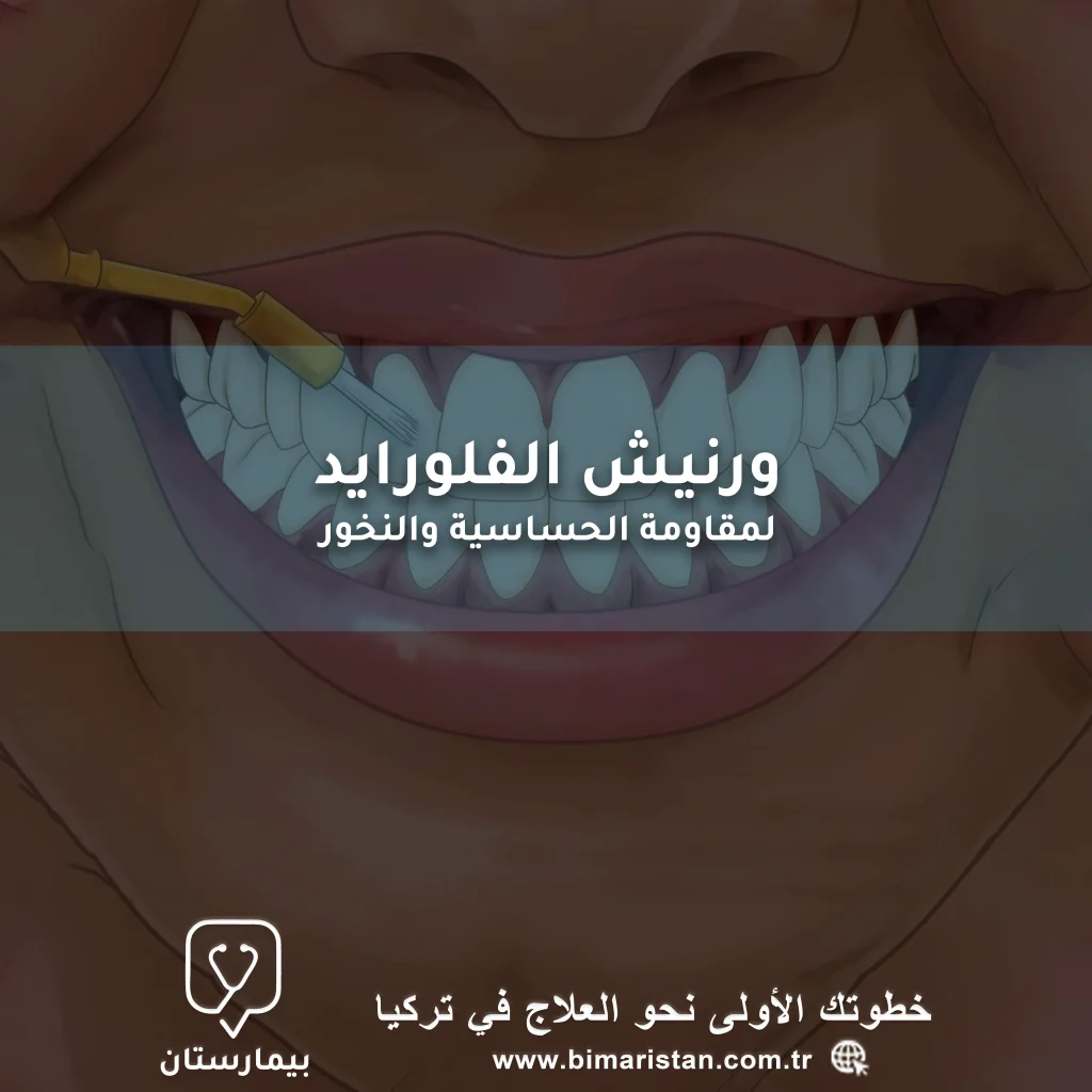 Boşlukları ve diş hassasiyetini önlemek için flor vernik kaplama