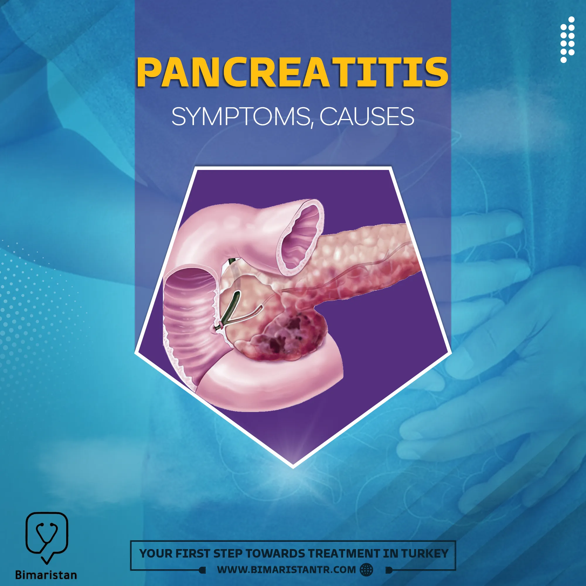 Symptoms and causes of pancreatitis
