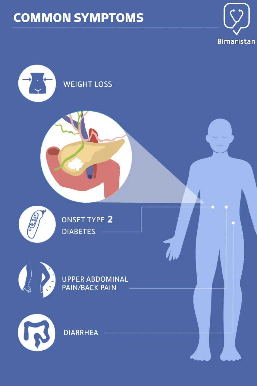 Symptoms of pancreatitis, the most important of which is upper abdominal pain towards the back 