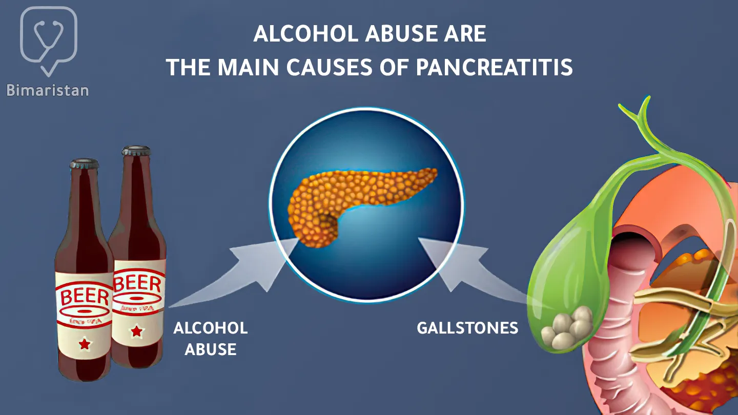 The most important causes of pancreatitis symptoms, which are gallstones and excessive alcohol consumption