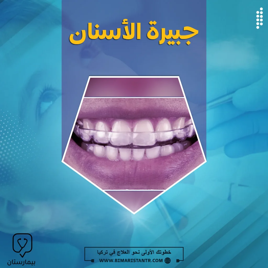 أنواع واستعمالات جبيرة الأأسنان