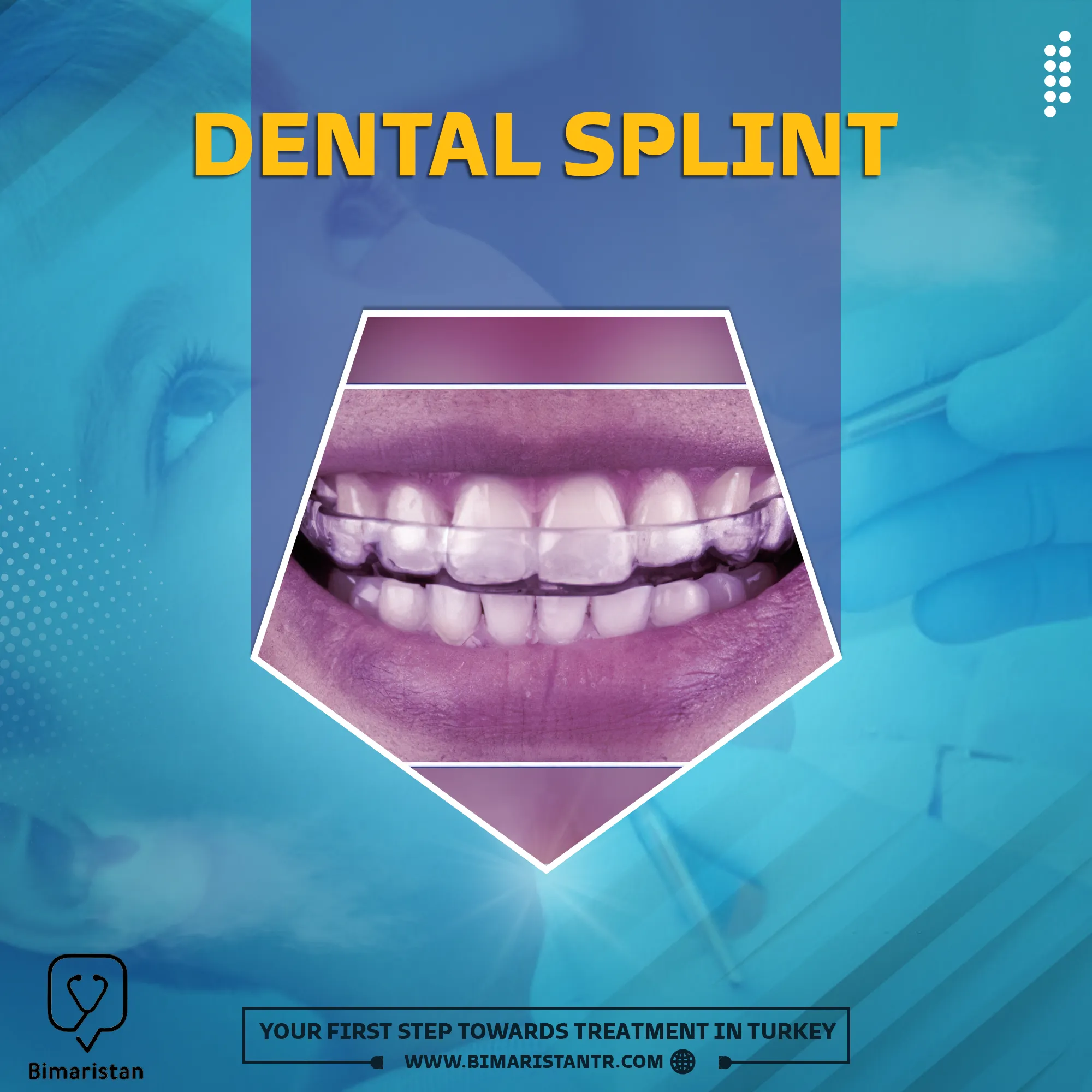Types and uses of dental splints