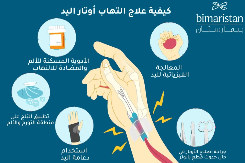 Bu resim el tendinitini tedavi etmek için kullanılan yöntemleri göstermektedir.