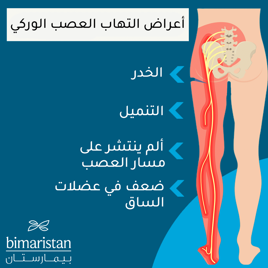 Symptoms of sciatica include numbness, tingling, pain, and muscle weakness