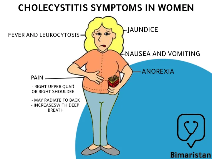The most common symptom of cholecystitis in women