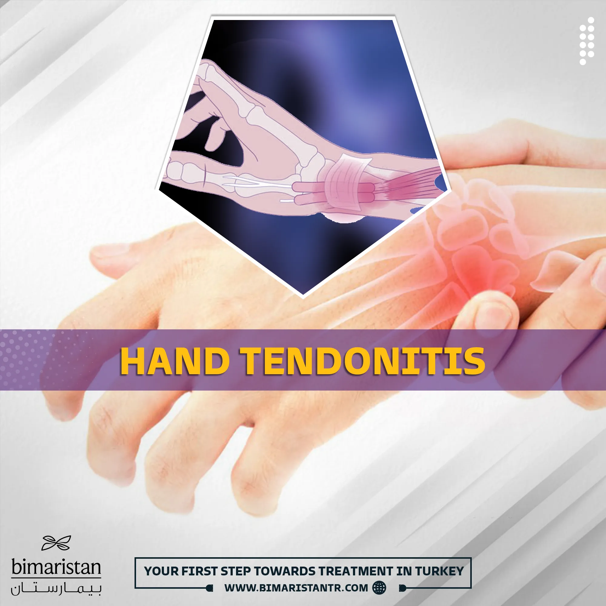 Hand tendonitis