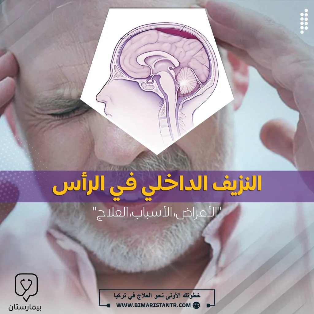 اعراض النزيف الداخلي في الرأس وكيفية علاجه