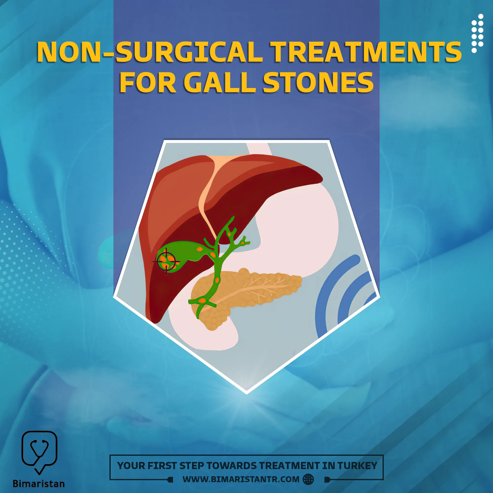 How to break up gallstones without surgery?