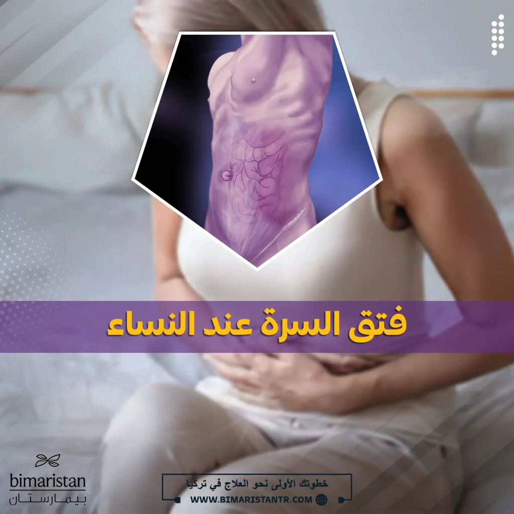 صورة غلاف لمقالة فتق السرة عند النساء