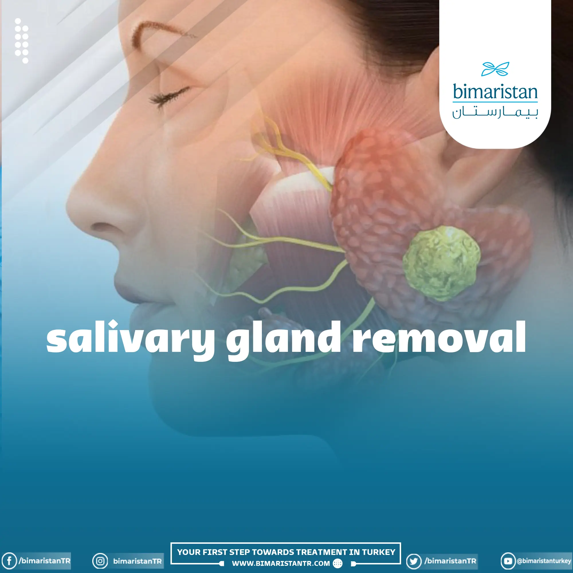 Salivary gland removal and its risks