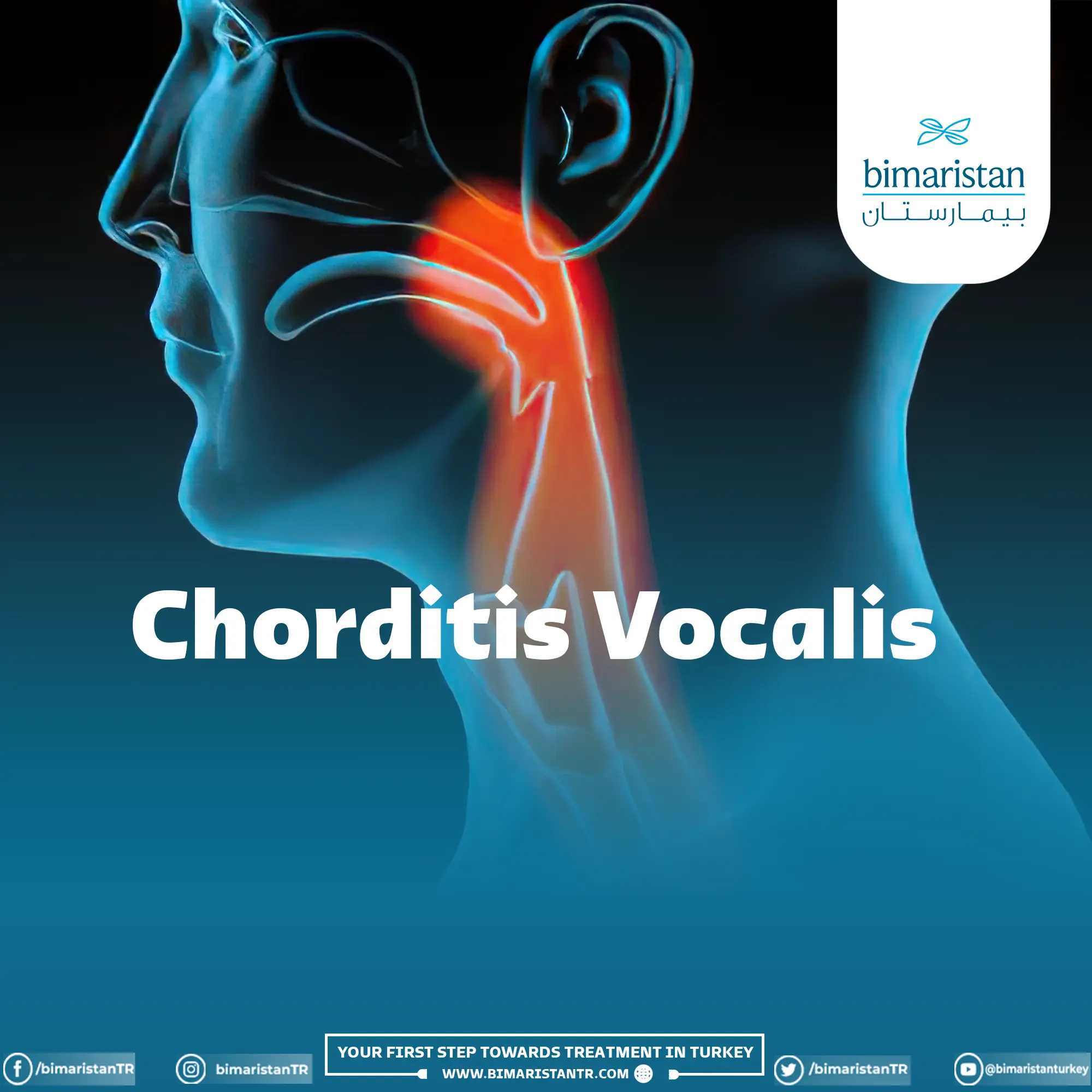 Cover image for the article Inflammation of the Vocal Cords