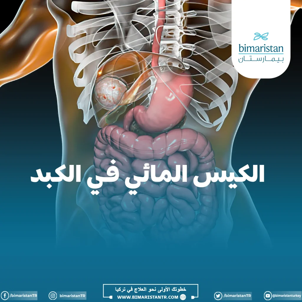 صورة غلاف لمقالة الكيس المائي في الكبد