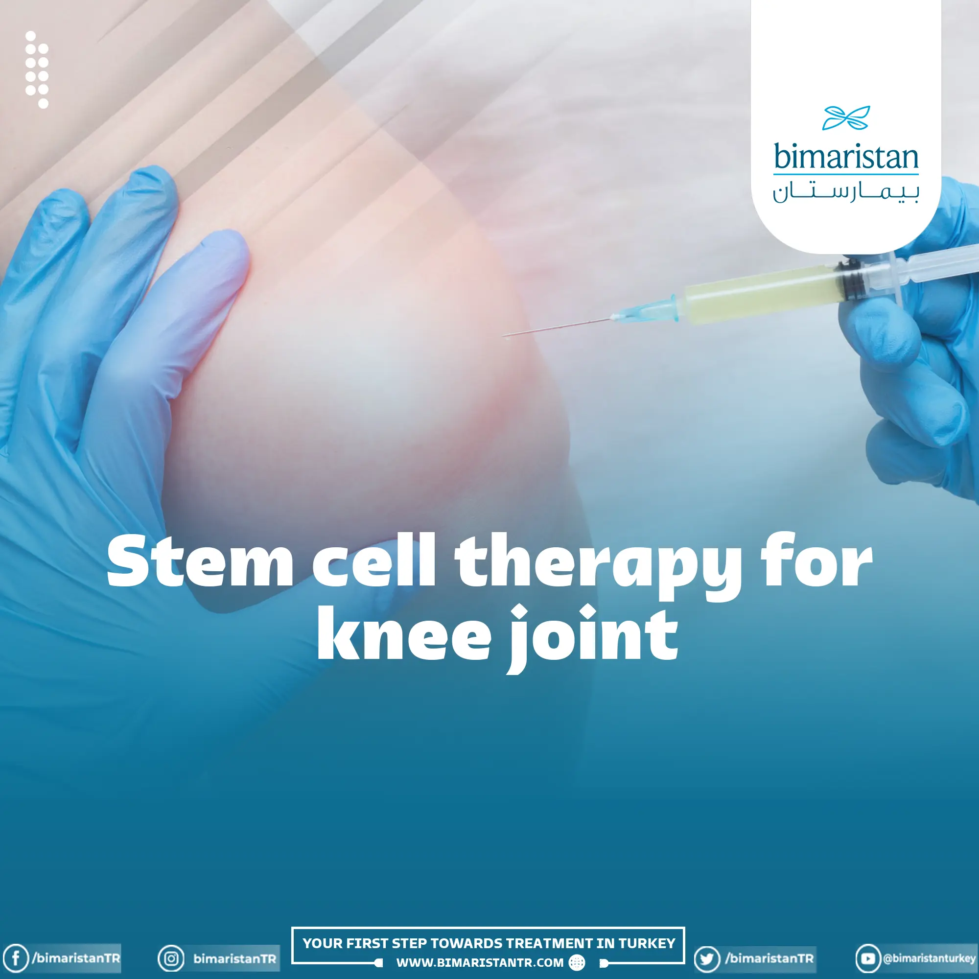 Knee stem cell injection in Turkey