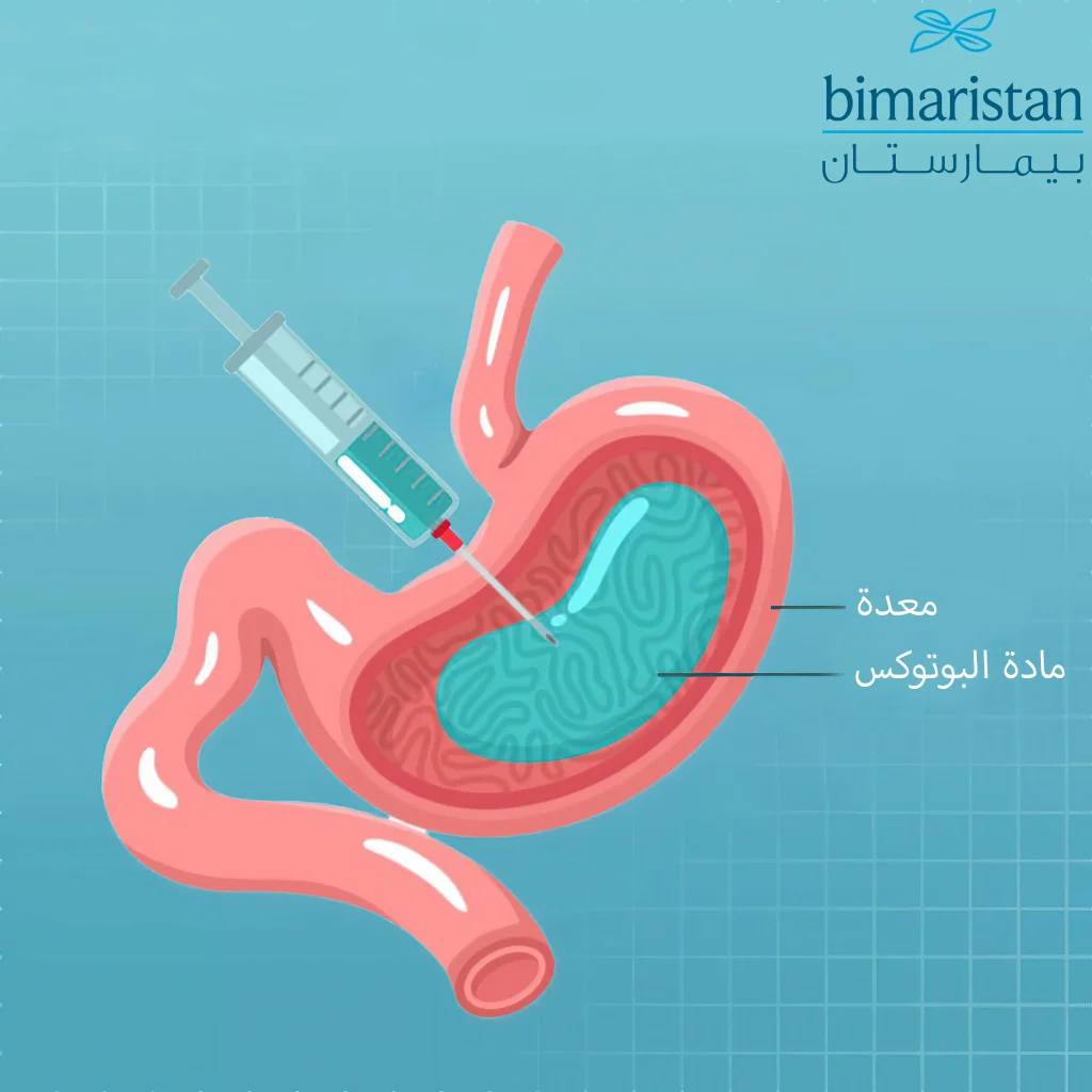 يحتاج حقن بوتكس المعدة في تركيا بعضًا من الوقت حتى تظهر النتائج بصورة واضحة