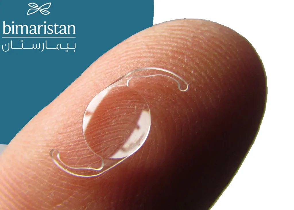 The shape of the artificial lens that is placed during the IOL implant surgery