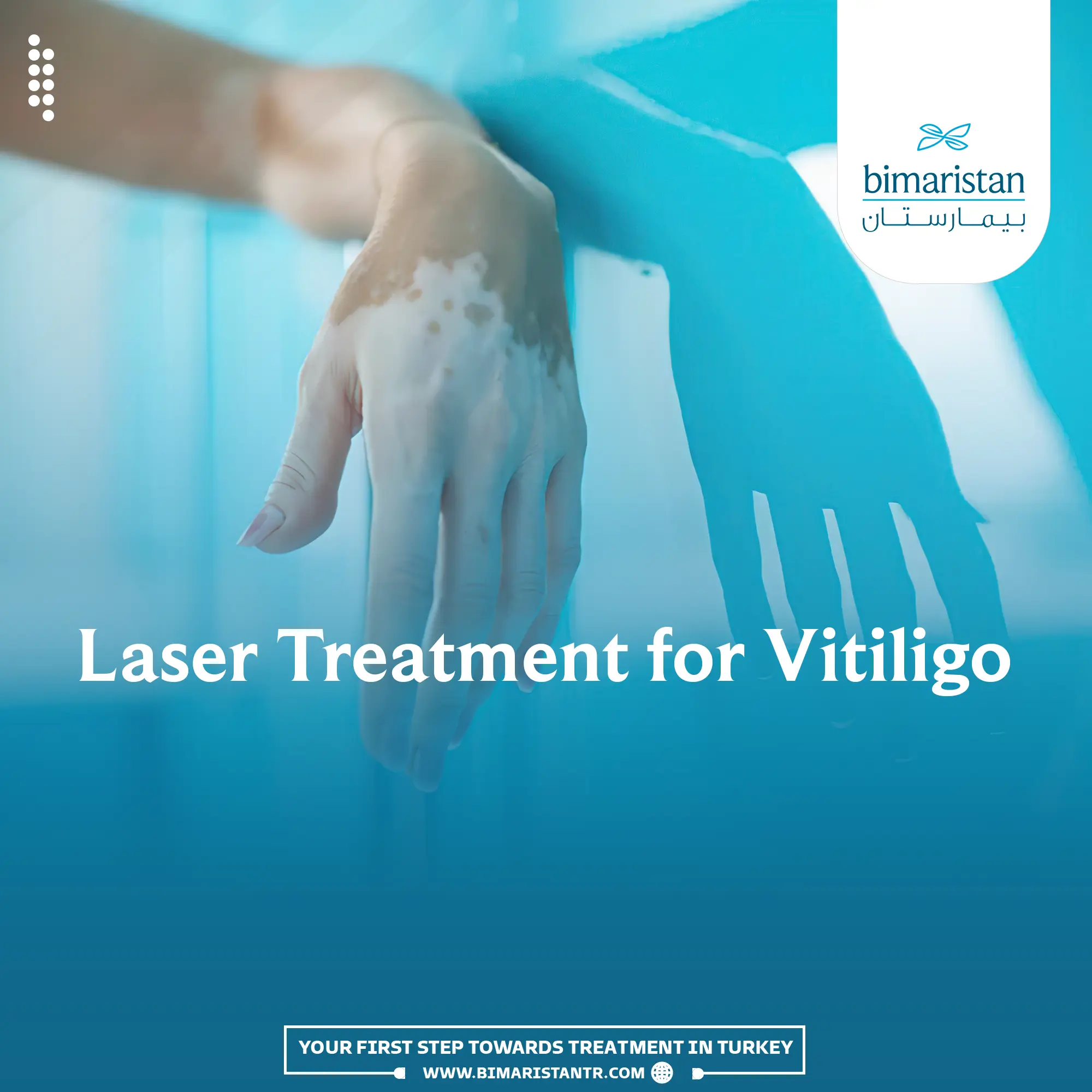 Laser treatment for vitiligo in Turkey