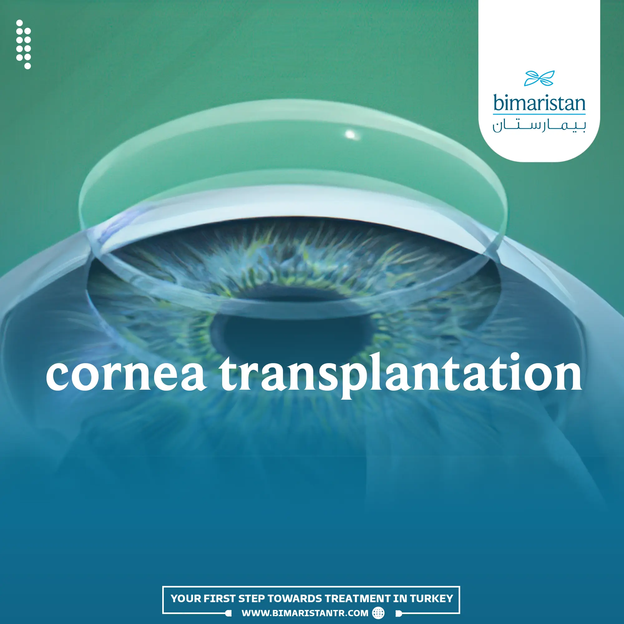 Corneal Transplantation In Turkey 2024