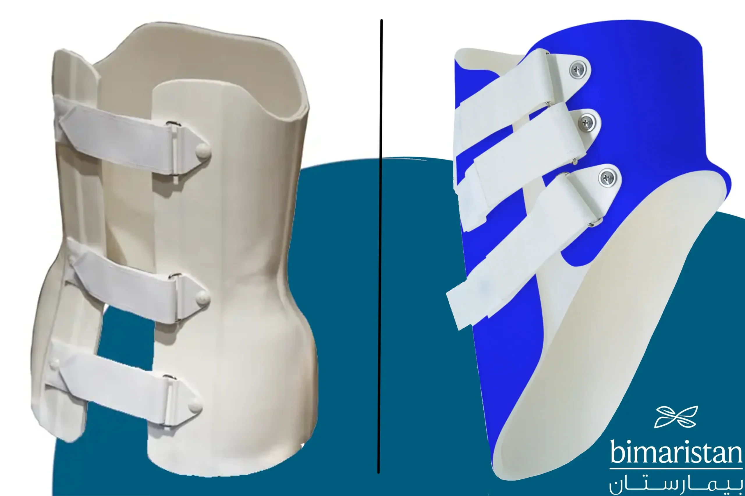 Skolyoz tedavisinde kullanılan diş tellerini, Providence korsesini (sağda) ve Boston korsesini (solda) gösteren görsel.