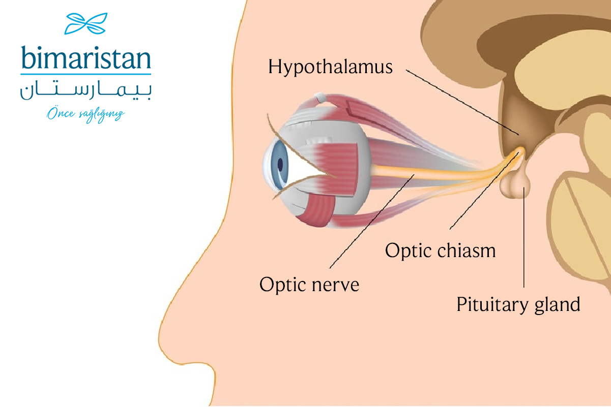 Image Showing The Location Of The Pituitary Gland In Relation To The Optic Chiasm