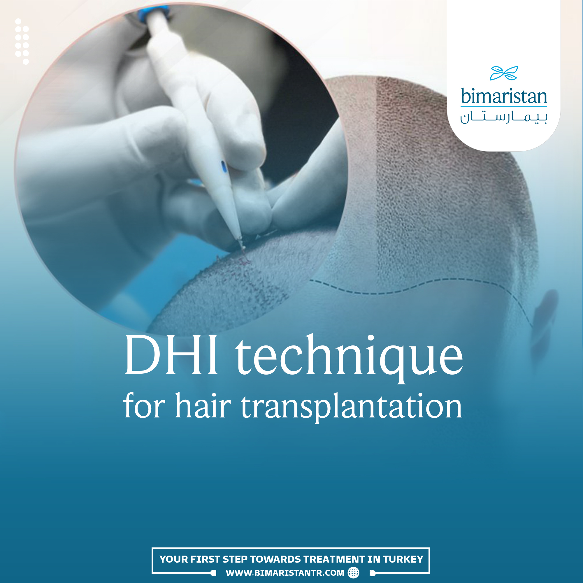 Cover image for the DHI Hair Transplant Technique article.