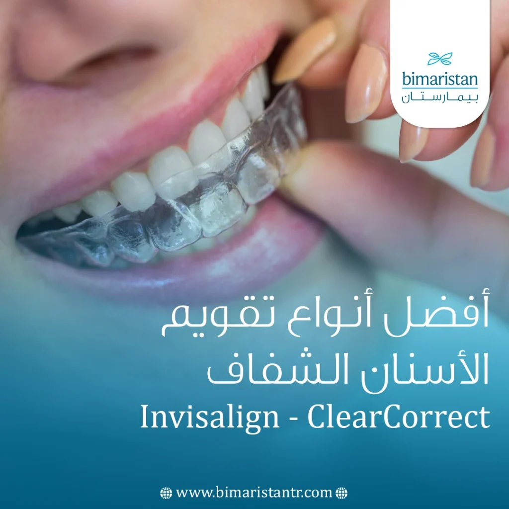 أفضل أنواع تقويم الأسنان الشفاف: Invisalign أم ClearCorrect؟