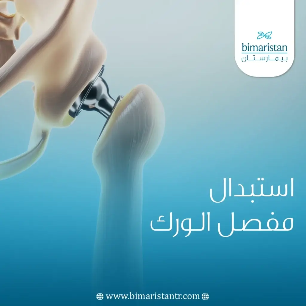 Hip joint replacement surgery