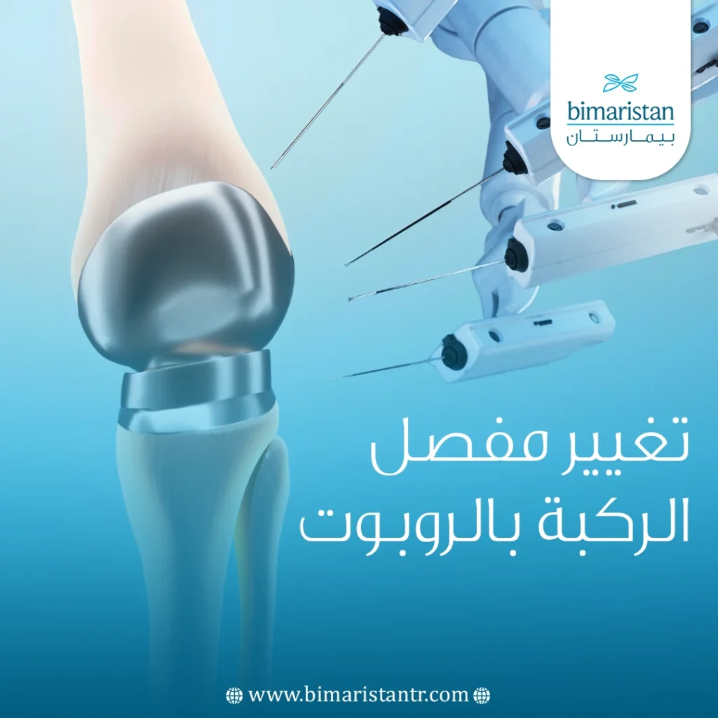 Robotic knee replacement