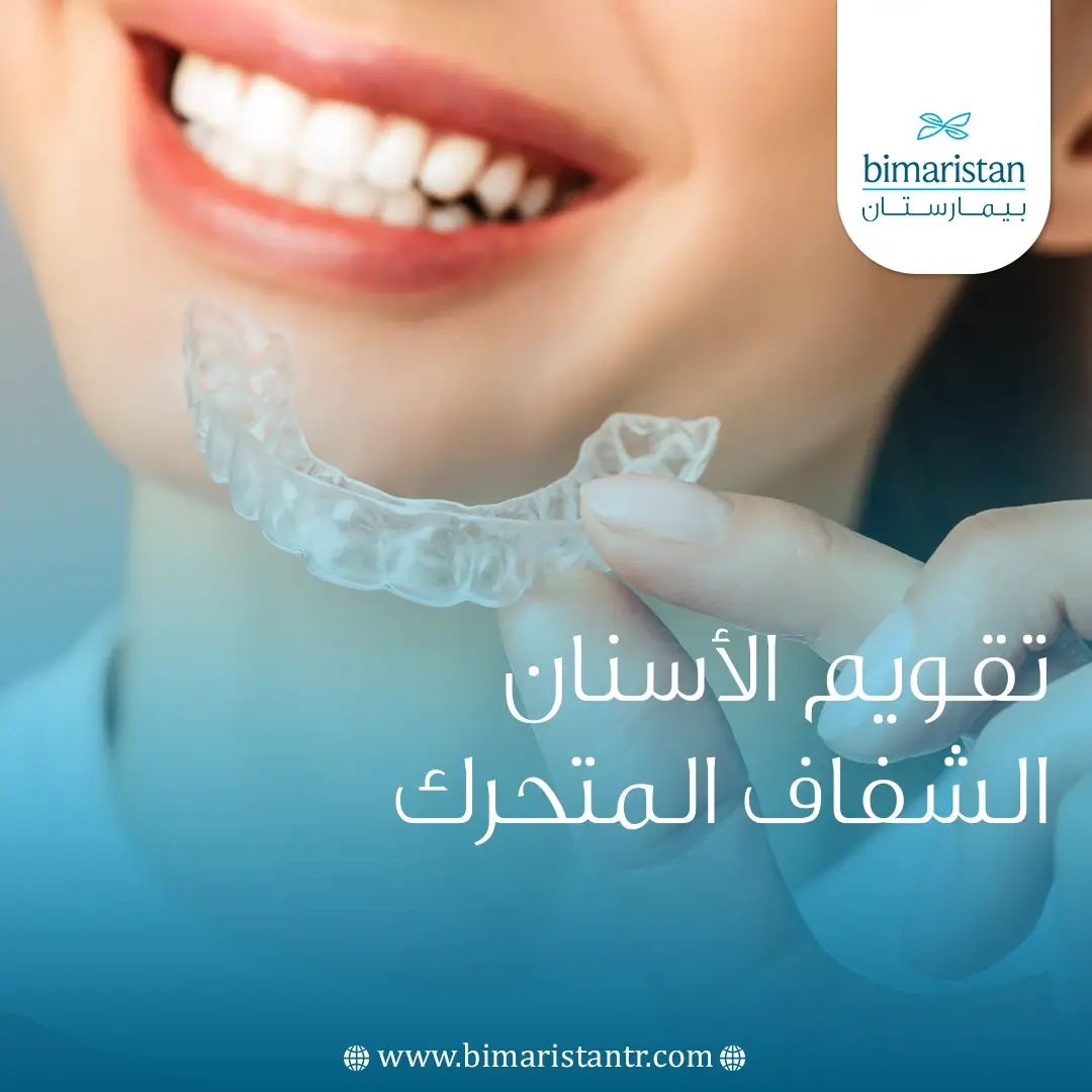 تقويم الأسنان الشفاف المتحرك