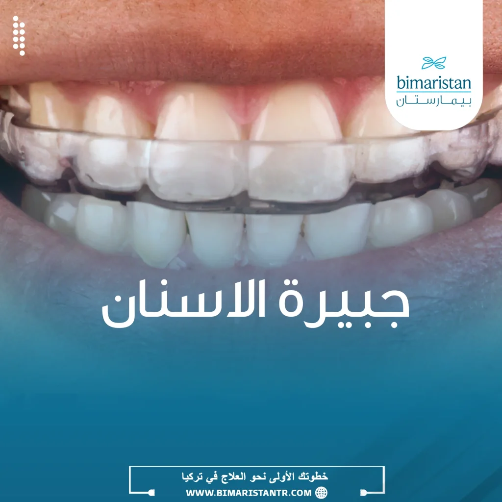 أنواع واستعمالات جبيرة الأسنان