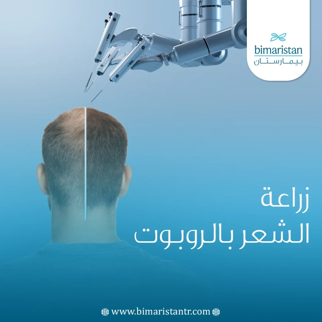 زراعة الشعر بالروبوت