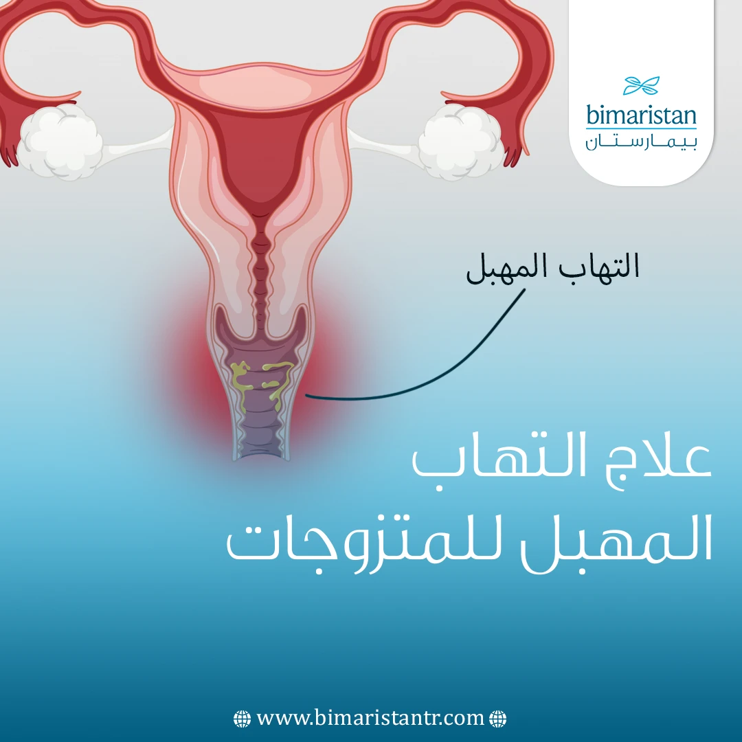 Learn everything useful about the treatment of vaginitis for married women