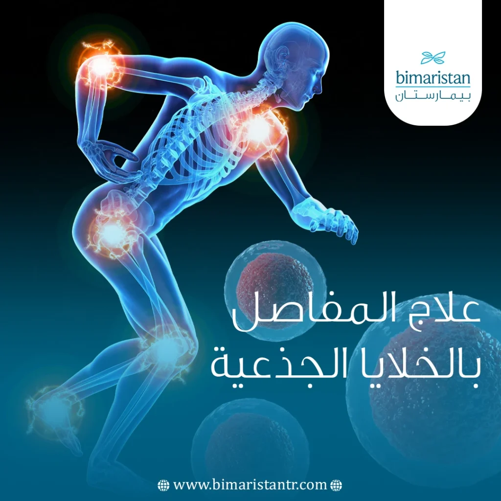 Stem cell joint treatment in Turkey