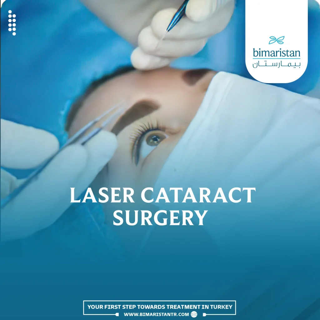 Laser-assisted Cataract Surgery