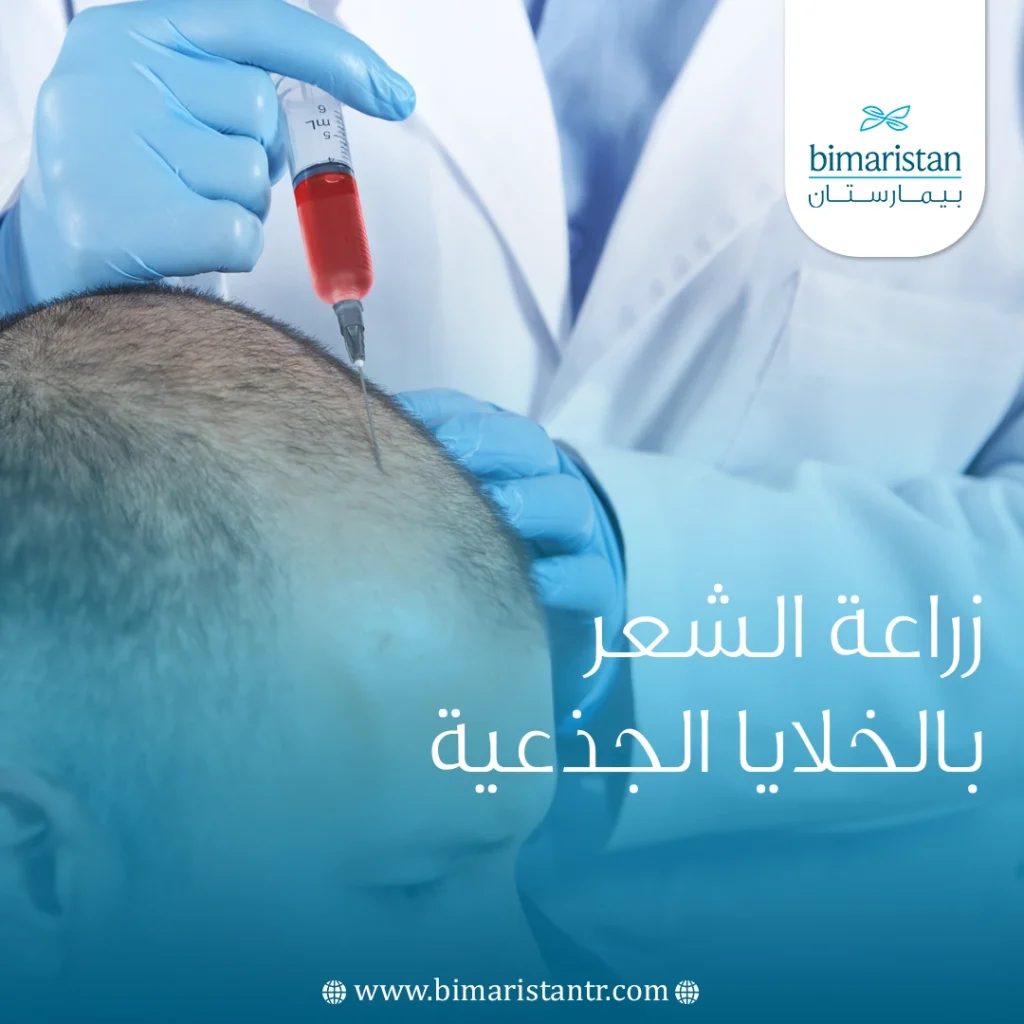 what are the Benefits of stem cells therapy for hair loss?