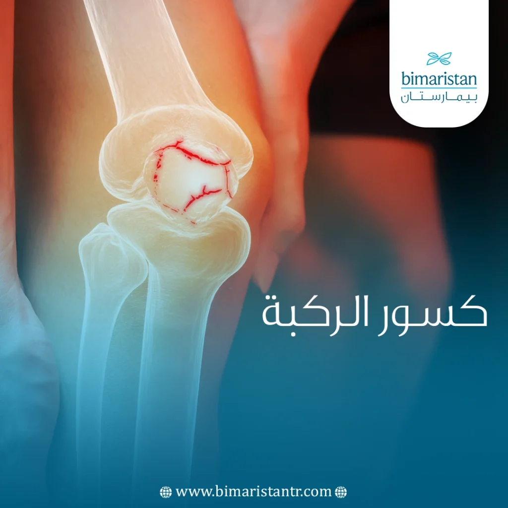 Knee fractures