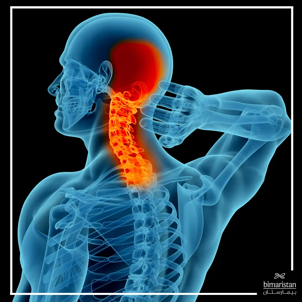 Neck pain in the back