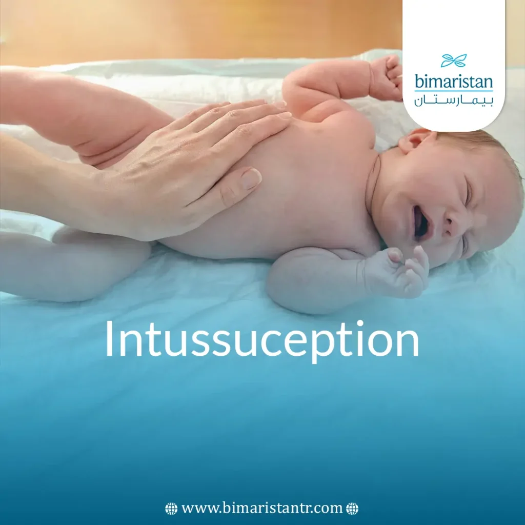 Infant Intussusception
