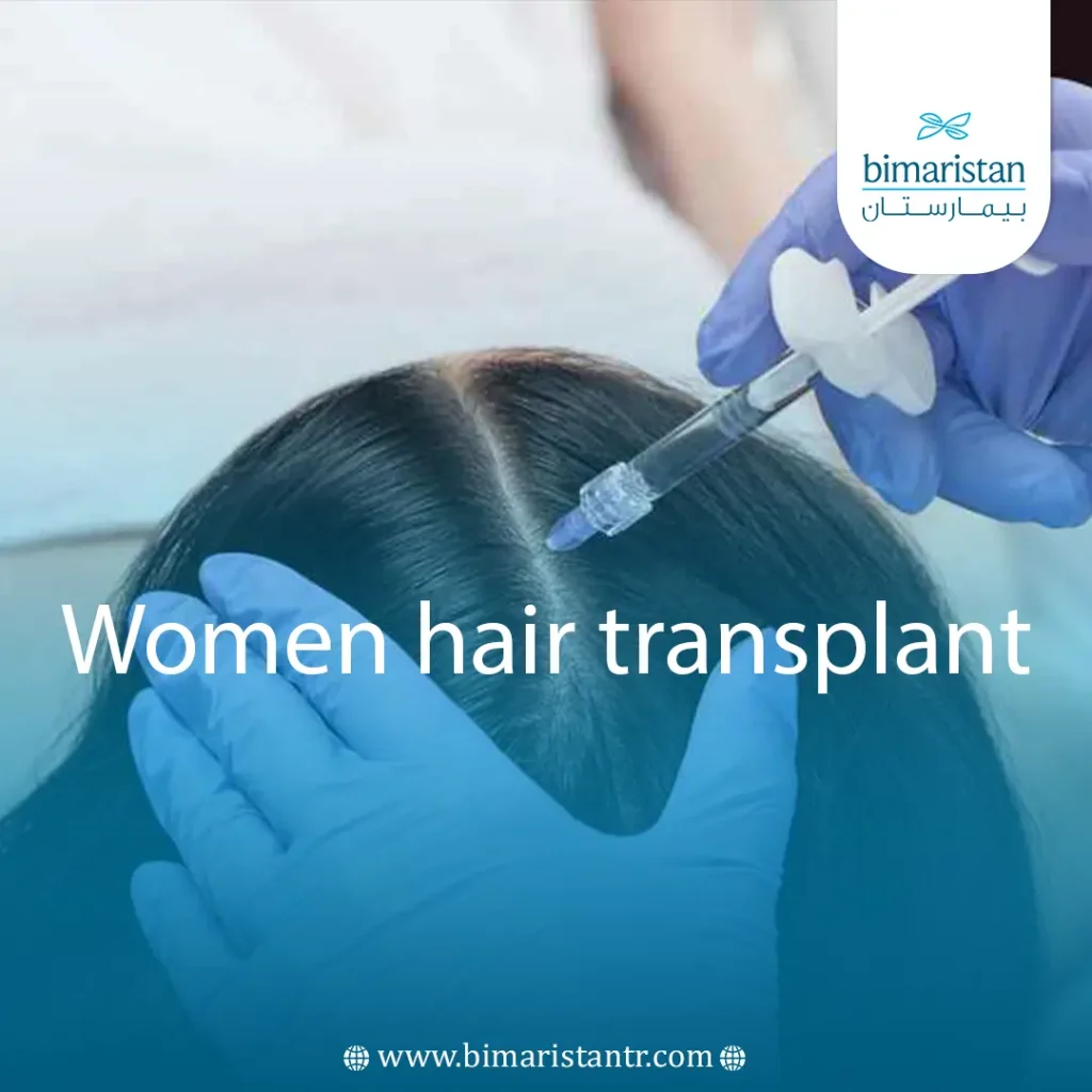 Image Of The Article About Hair Transplantation In Women