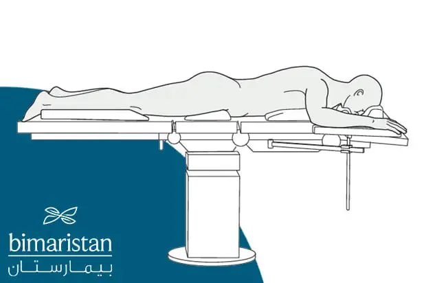 Patient positioning during the endoscopic discectomy procedure.