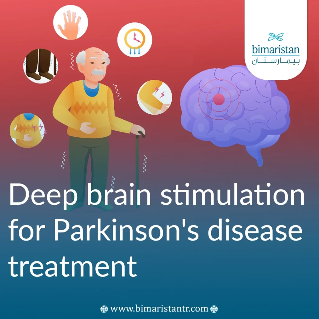 Deep brain stimulation for Parkinson_s disease treatment
