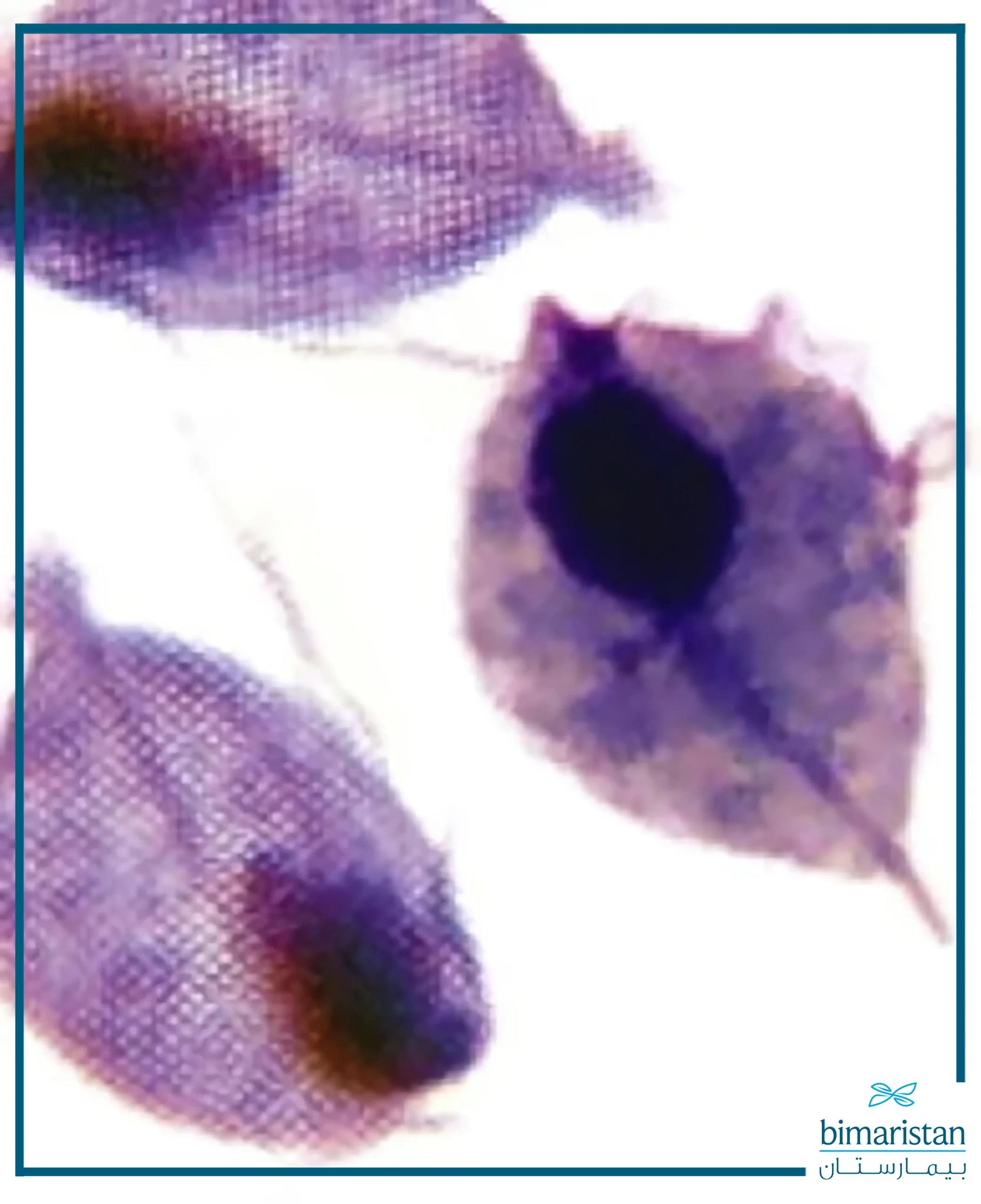 A picture illustrating trichomonas vaginalis under the microscope.