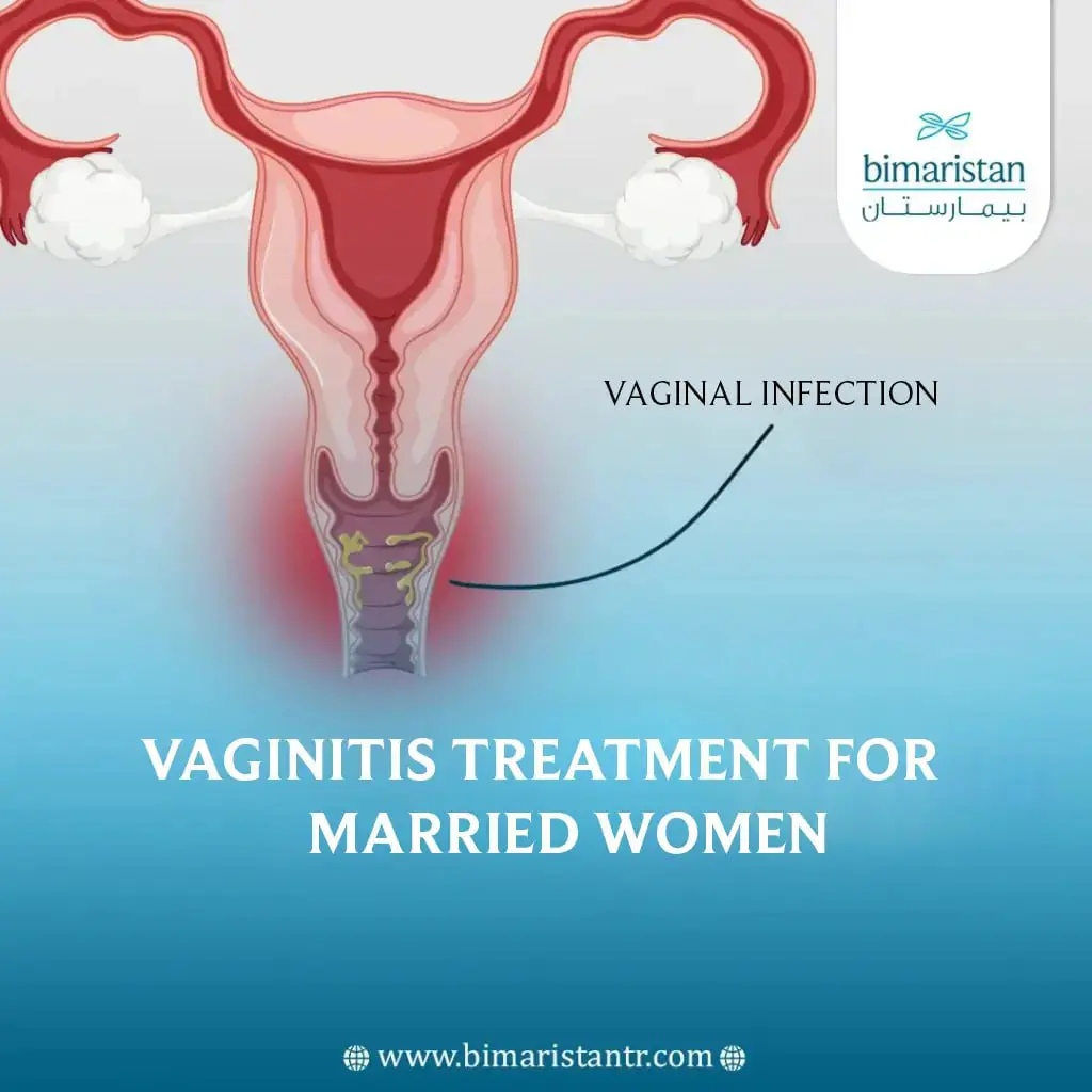 vaginitis treatment for married women