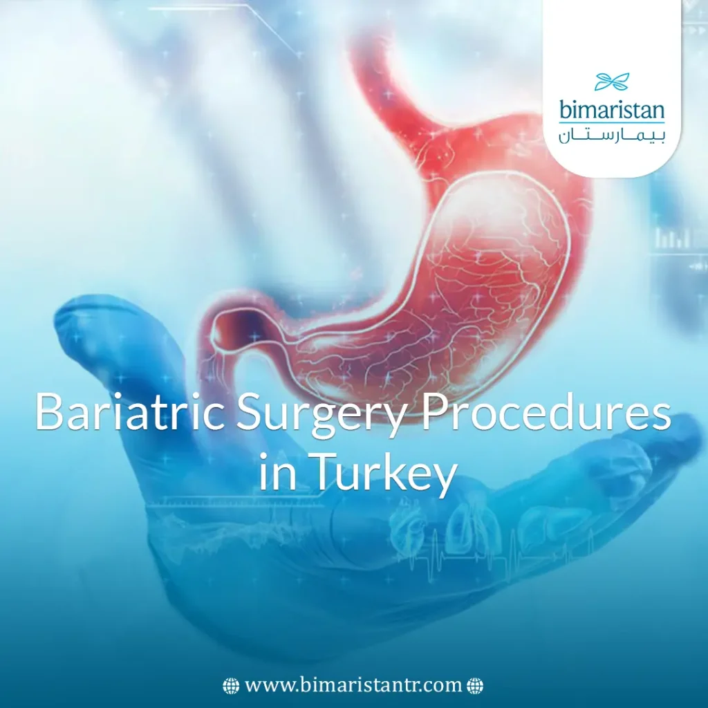 Types of Bariatric Surgery in Turkey