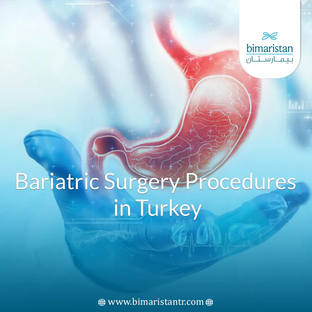 Types Of Bariatric Surgery In Turkey