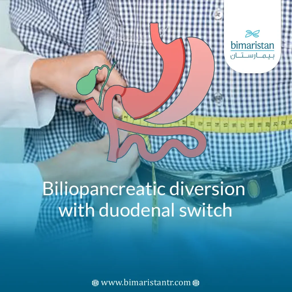 Post-Operative Diet Stages for Duodenal Switch (BPD/DS)