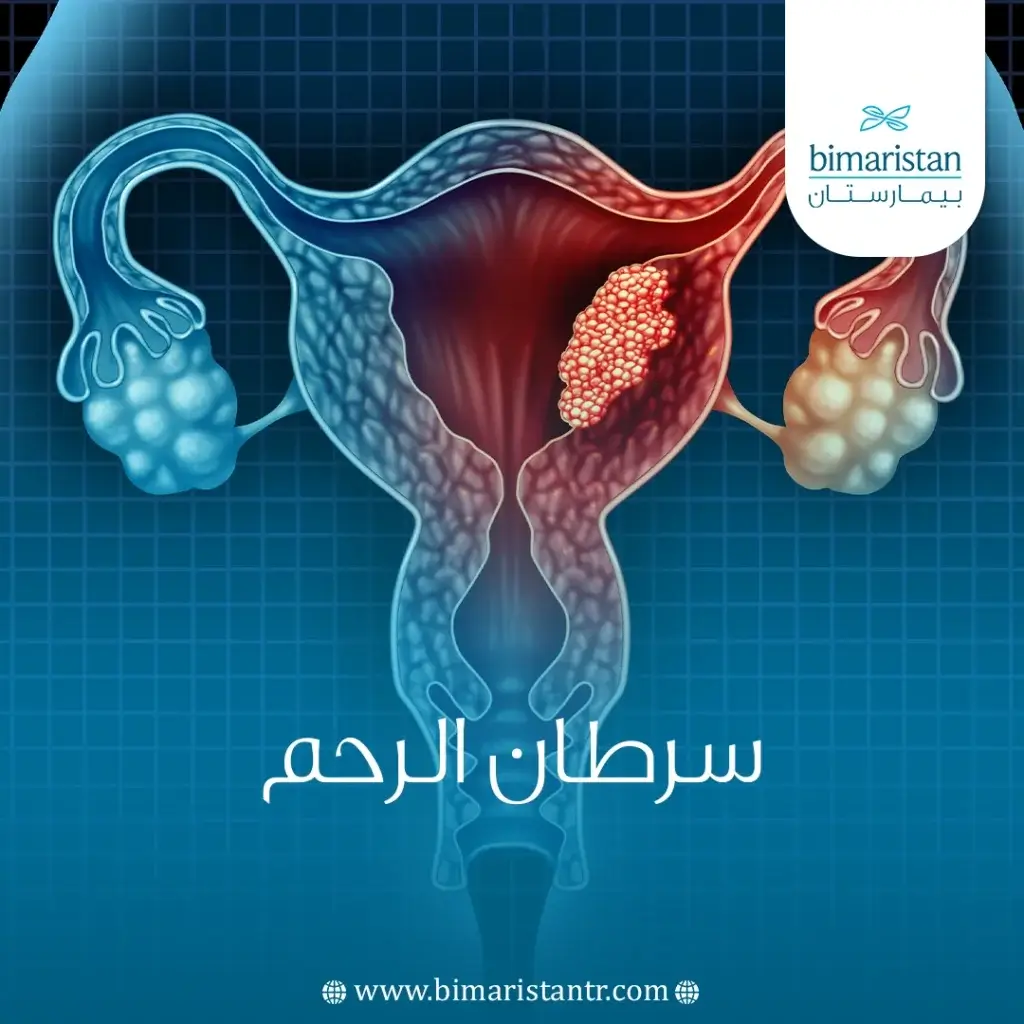 اسباب واعراض وطرق علاج سرطان بطانة الرحم في تركيا