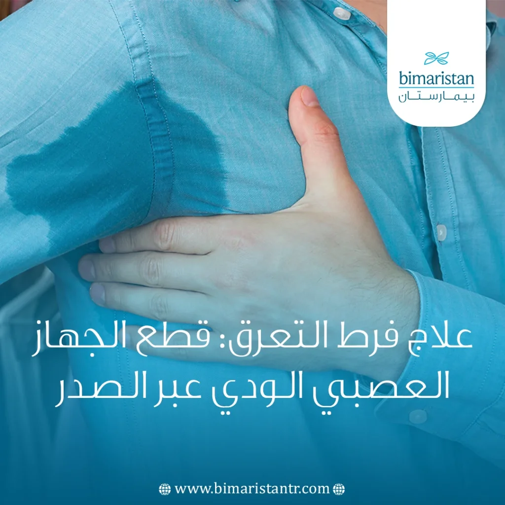 جراحة قطع الودي الصدري | علاج فرط التعرق بشكل نهائي