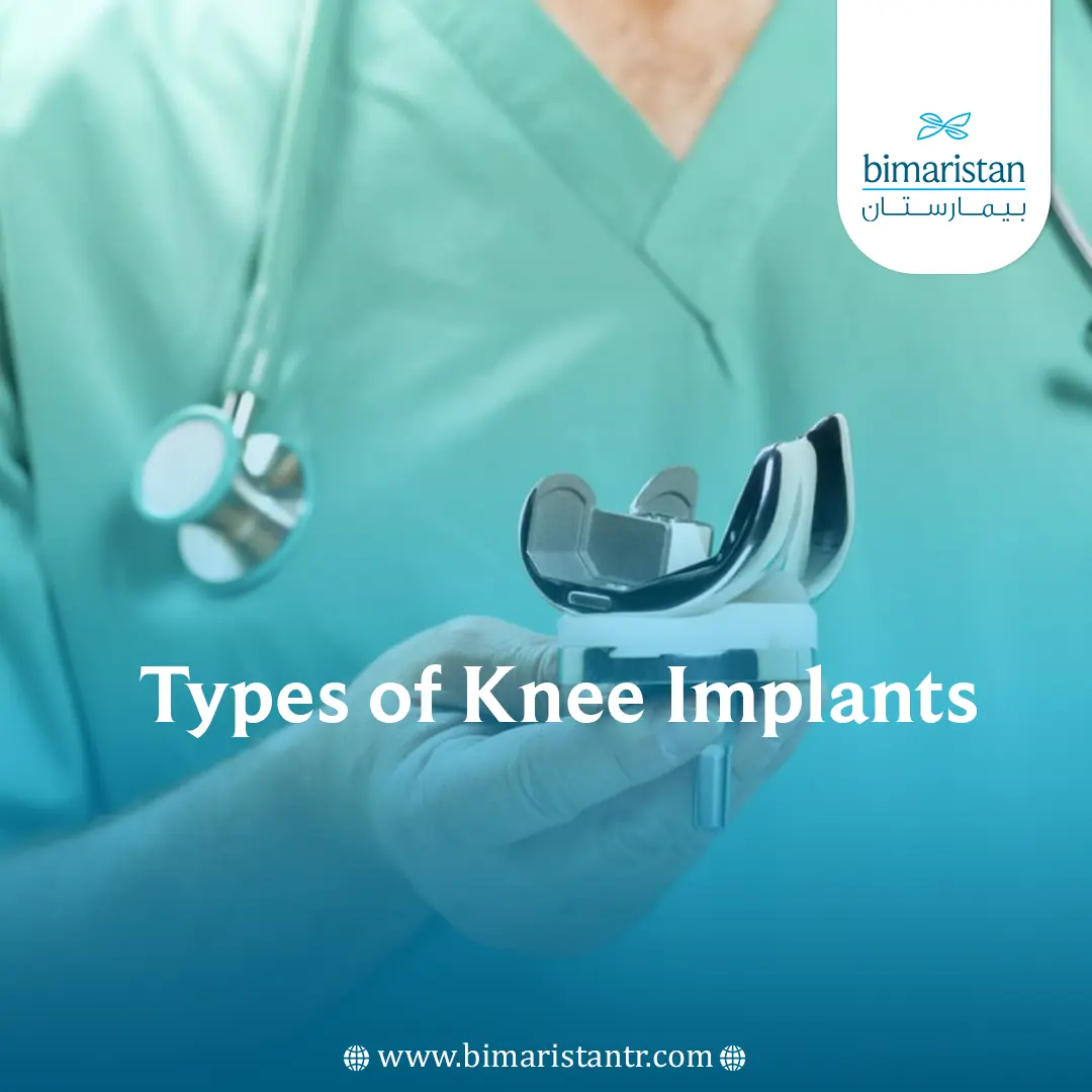 Best Types Of Knee Implants In Turkey - Bimaristan