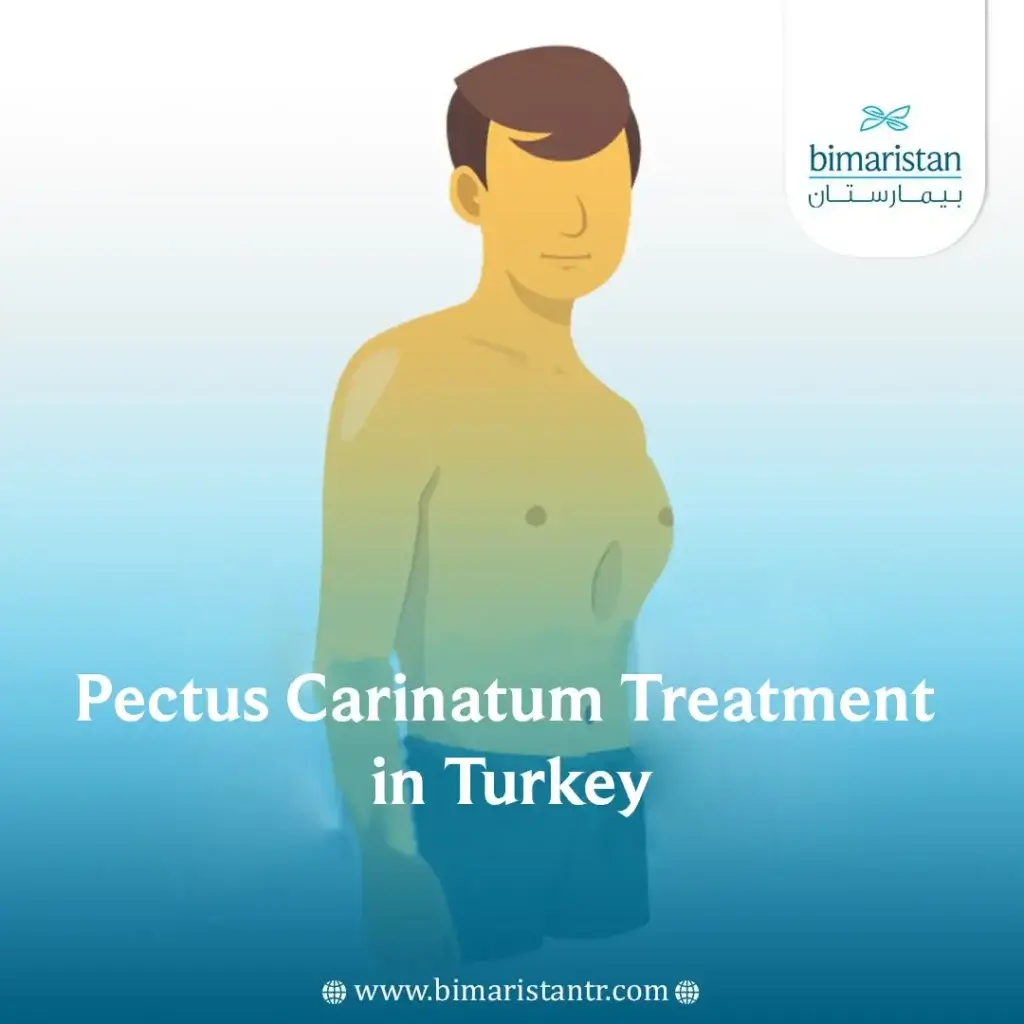 Pectus Carinatum: Causes And Treatment Of Chest Bone Protrusion In Turkey